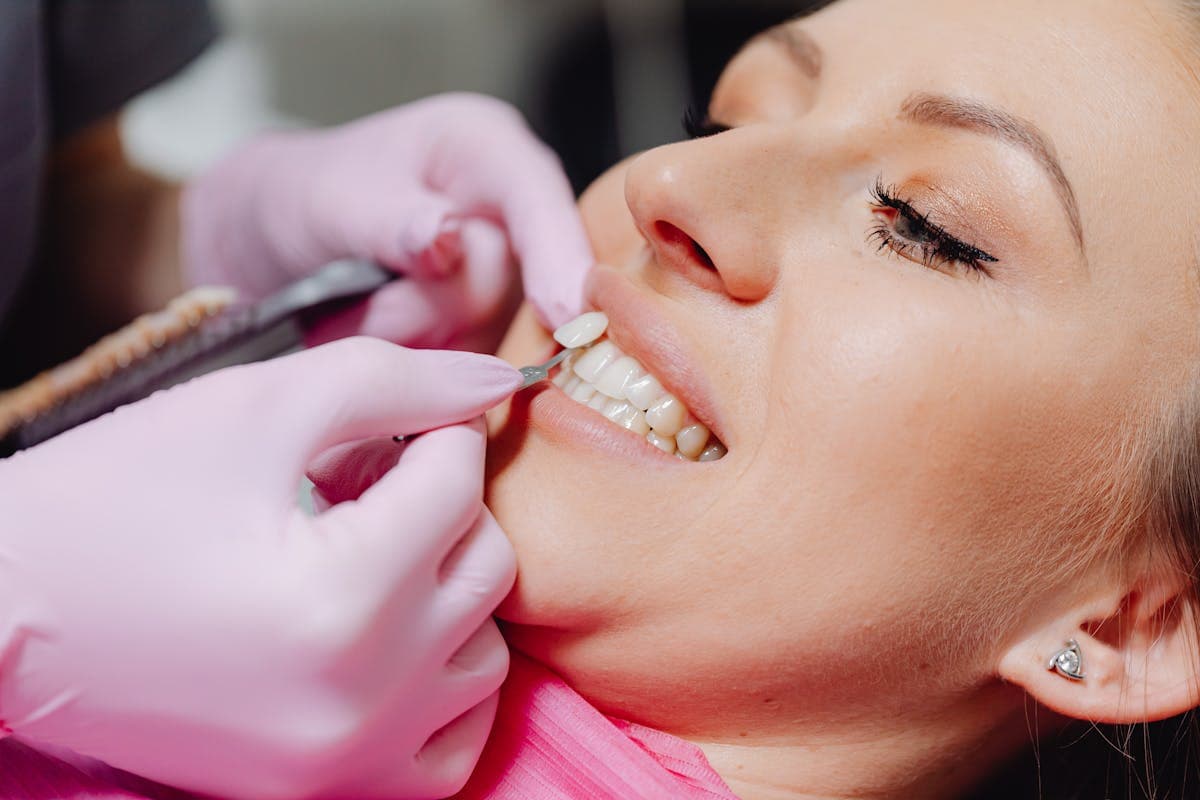 Albire dentară profesională Bacău — ședință de albire cu lampă LED și gel de peroxid la Chromatic Dental Clinic