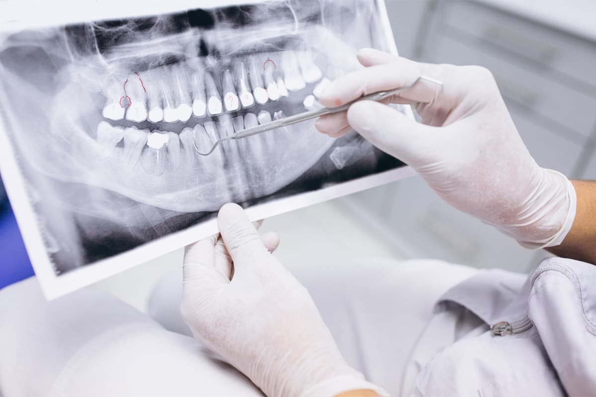 Evaluare ortodontică pe radiografie panoramică pentru alignere transparente la Chromatic Dental Bacău