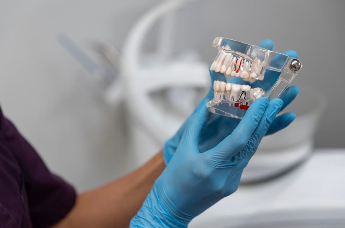 All-on-4 Bacău — model dentar transparent folosit pentru planificarea lucrării provizorii fixe în 24-48 ore la Chromatic Dental