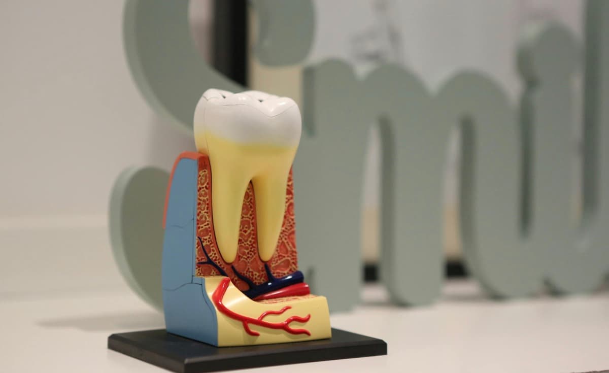 Tratament canal Bacău — secțiune anatomică prin dinte cu pulpa și canalele radiculare, explicată la Chromatic Dental