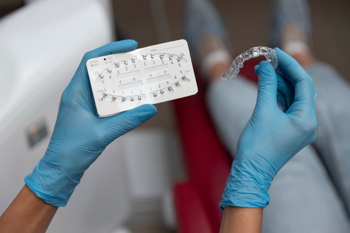 Aparat dentar metalic vs. invizibil: ce să alegi în 2026