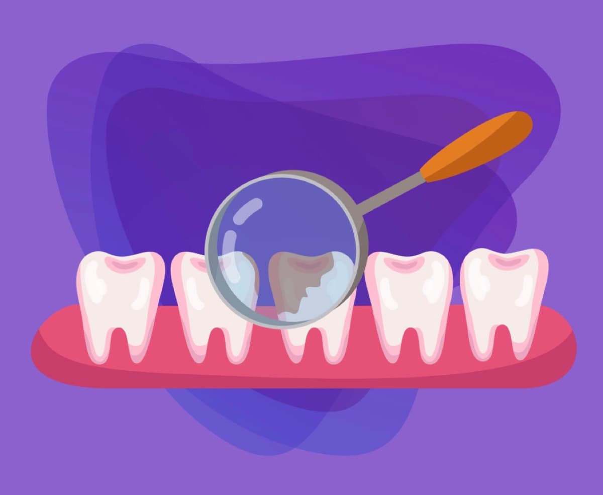 Biofilm bacterian pe dinți Bacău — detectare cu colorant la igienizarea GBT, Chromatic Dental Clinic