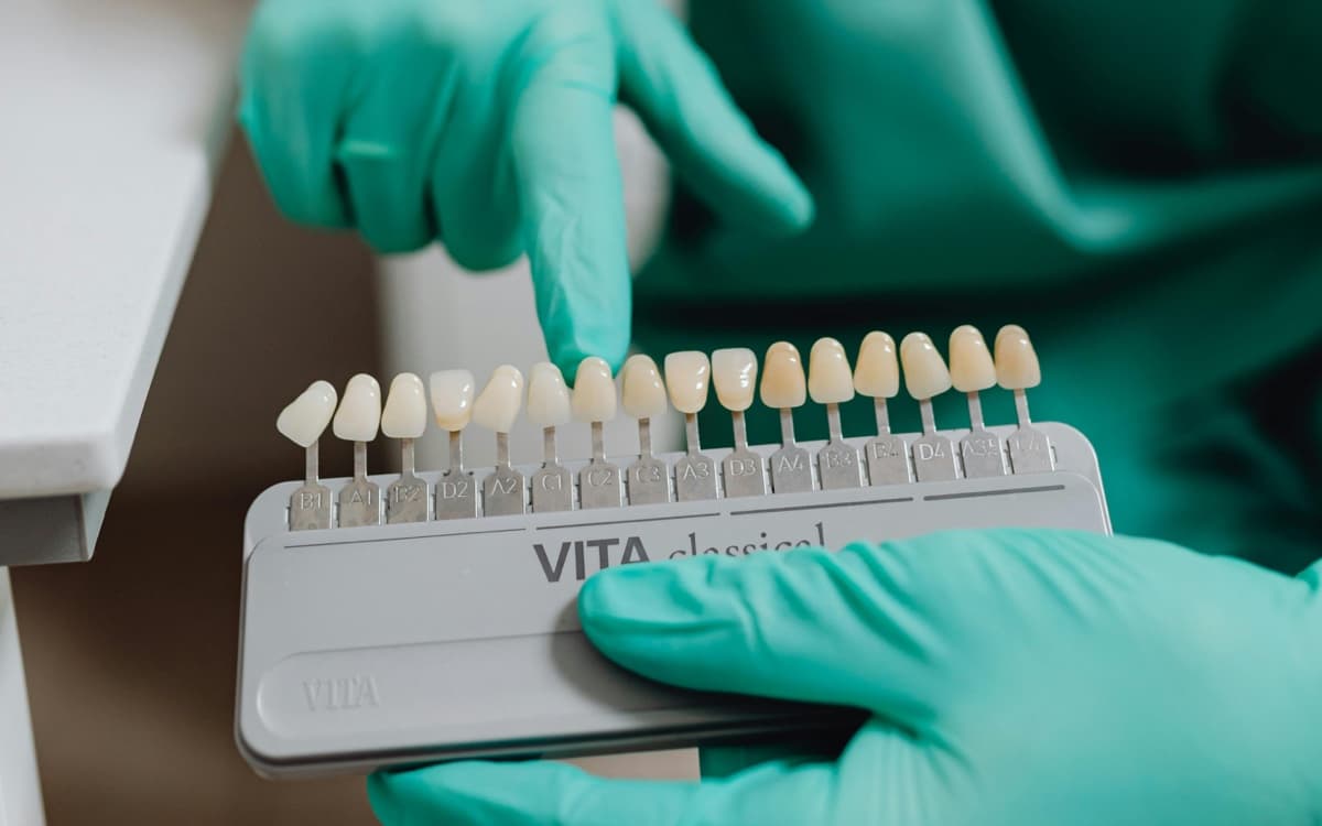 Estetică dentară Bacău — zâmbet natural cu dinți uniformi după fațete ceramice la Chromatic Dental Clinic