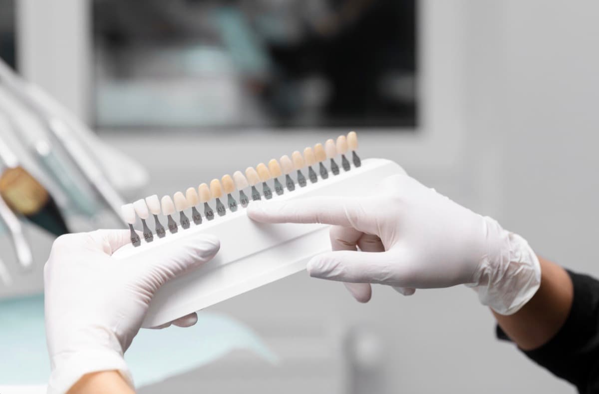 Fațete dentare Bacău — paletă cu nuanțe de culoare folosită pentru alegerea fațetelor ceramice la Chromatic Dental