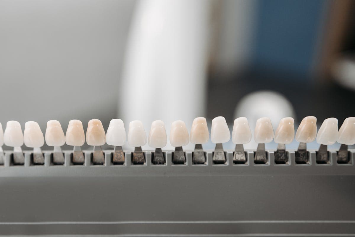 Fațete dentare vs. coroane Bacău — model comparativ cu fațetă ceramică pe fața dintelui și coroană care îmbracă dintele complet, la Chromatic Dental