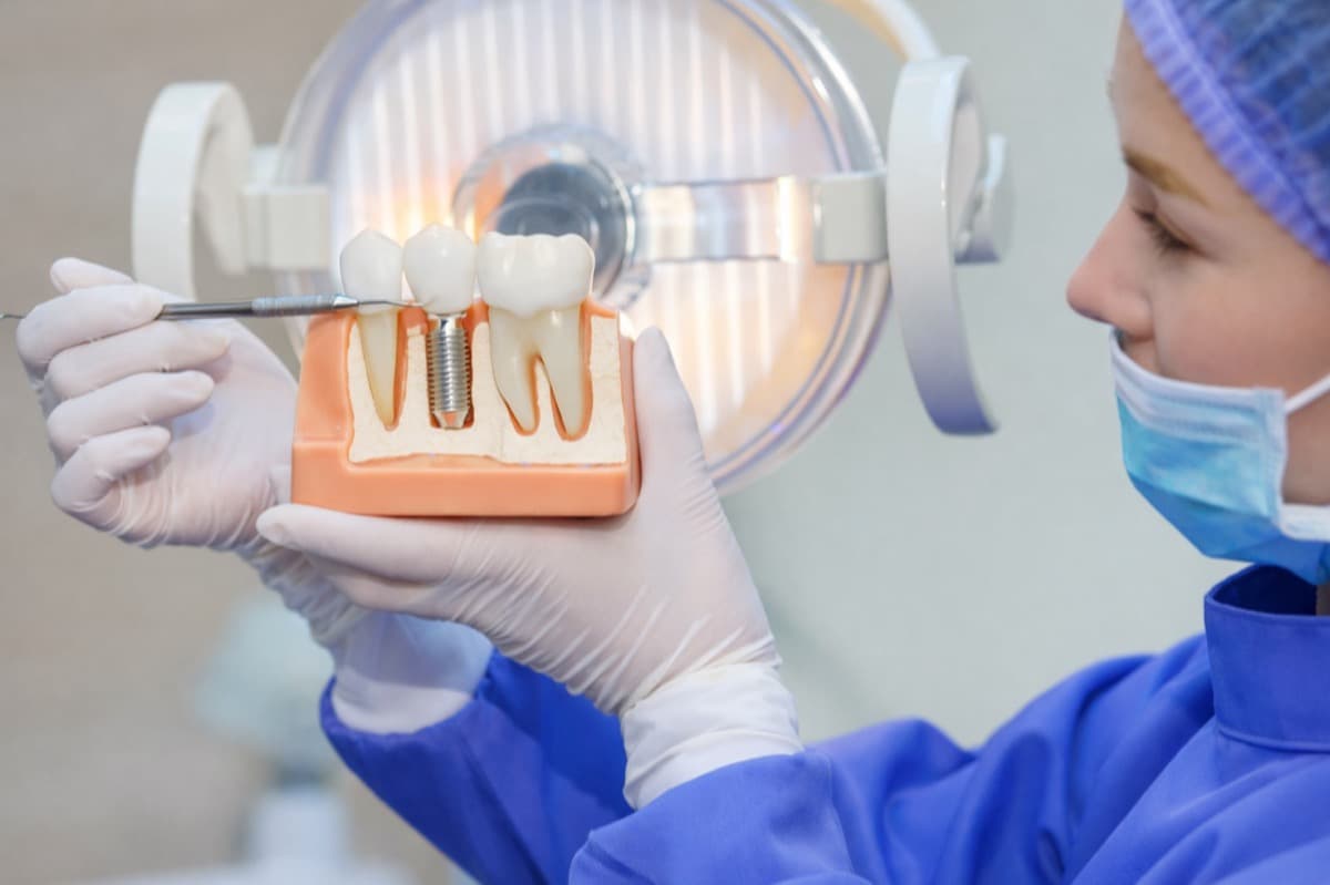 Implant dentar după extracția unui dinte: când, cum și cât aștepți
