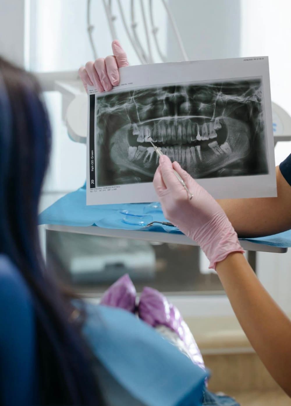 Implant dentar de lungă durată Bacău — medic stomatolog explică pacientei radiografia panoramică pentru planificarea implantului la Chromatic Dental Clinic