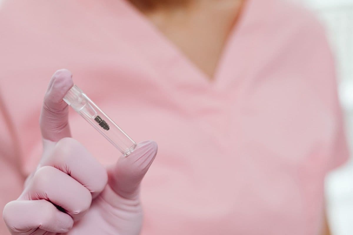 Implant dentar pregătit pentru bont și coroană pe implant la clinica din Bacău