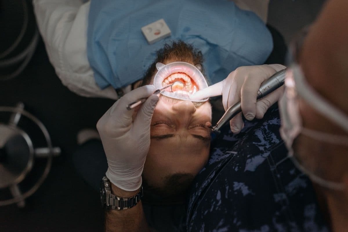 Control al gingiei din jurul implantului pentru periimplantită la clinica din Bacău