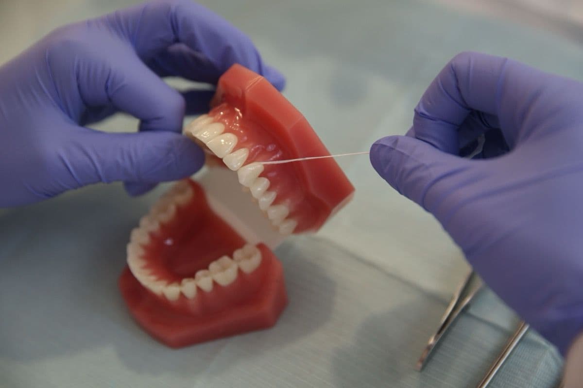 Folosirea aței dentare pe model, pentru îngrijirea coroanei pe implant, la clinica din Bacău