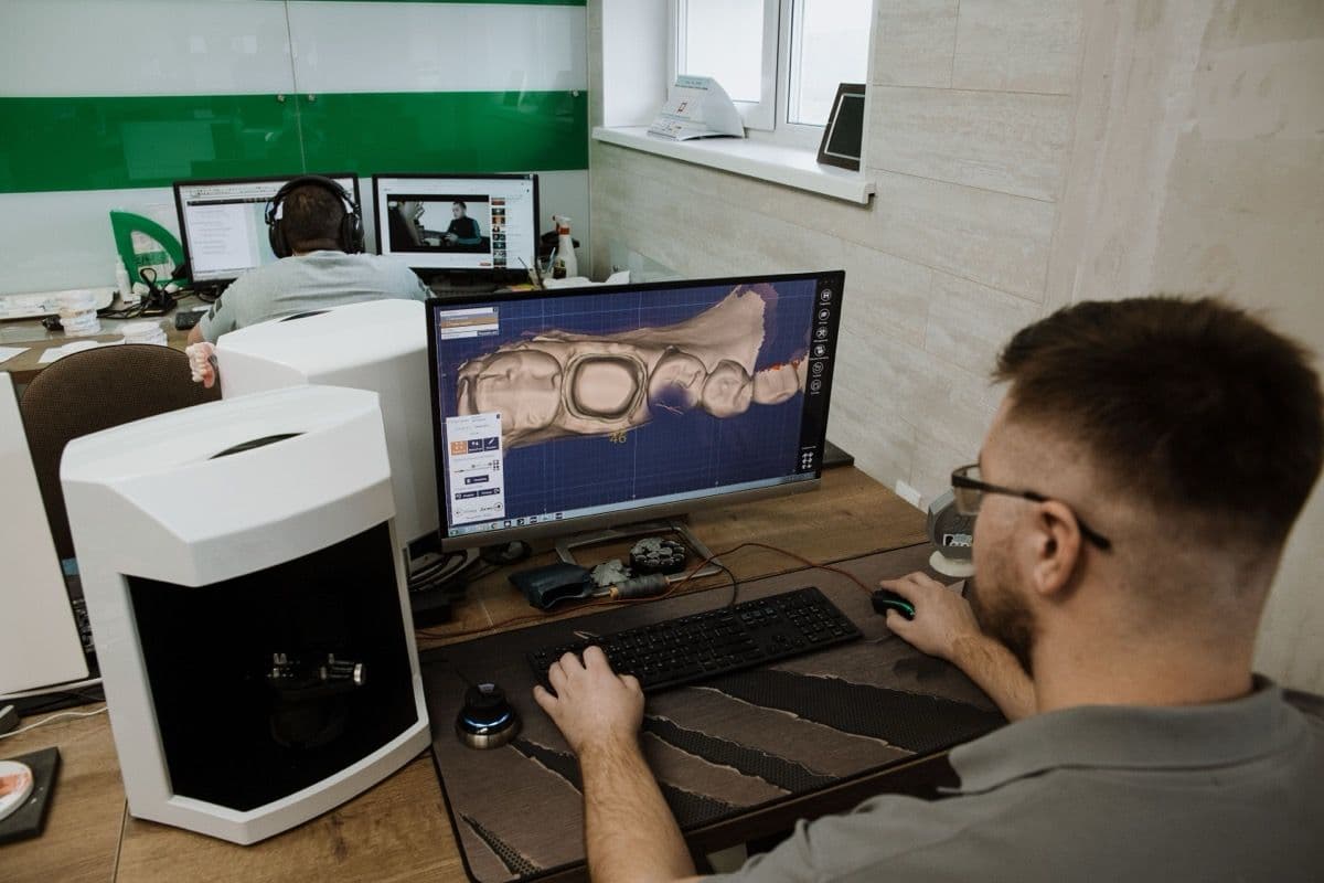 Proiectarea digitală a unei coroane pe implant după scanarea intraorală, pentru pacienți din Bacău