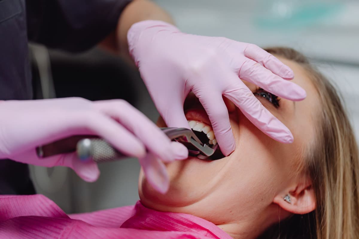Extracție dentară Bacău — intervenție sub anestezie locală la Chromatic Dental Clinic