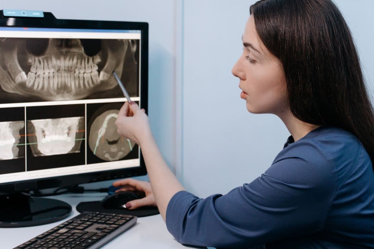 Medic stomatolog care planifică poziția implantului pe secțiunile CBCT, pentru chirurgie ghidată în Bacău