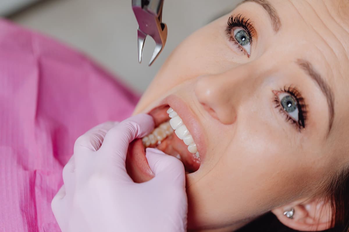 Medic realizând o extracție dentară sub anestezie locală în Bacău