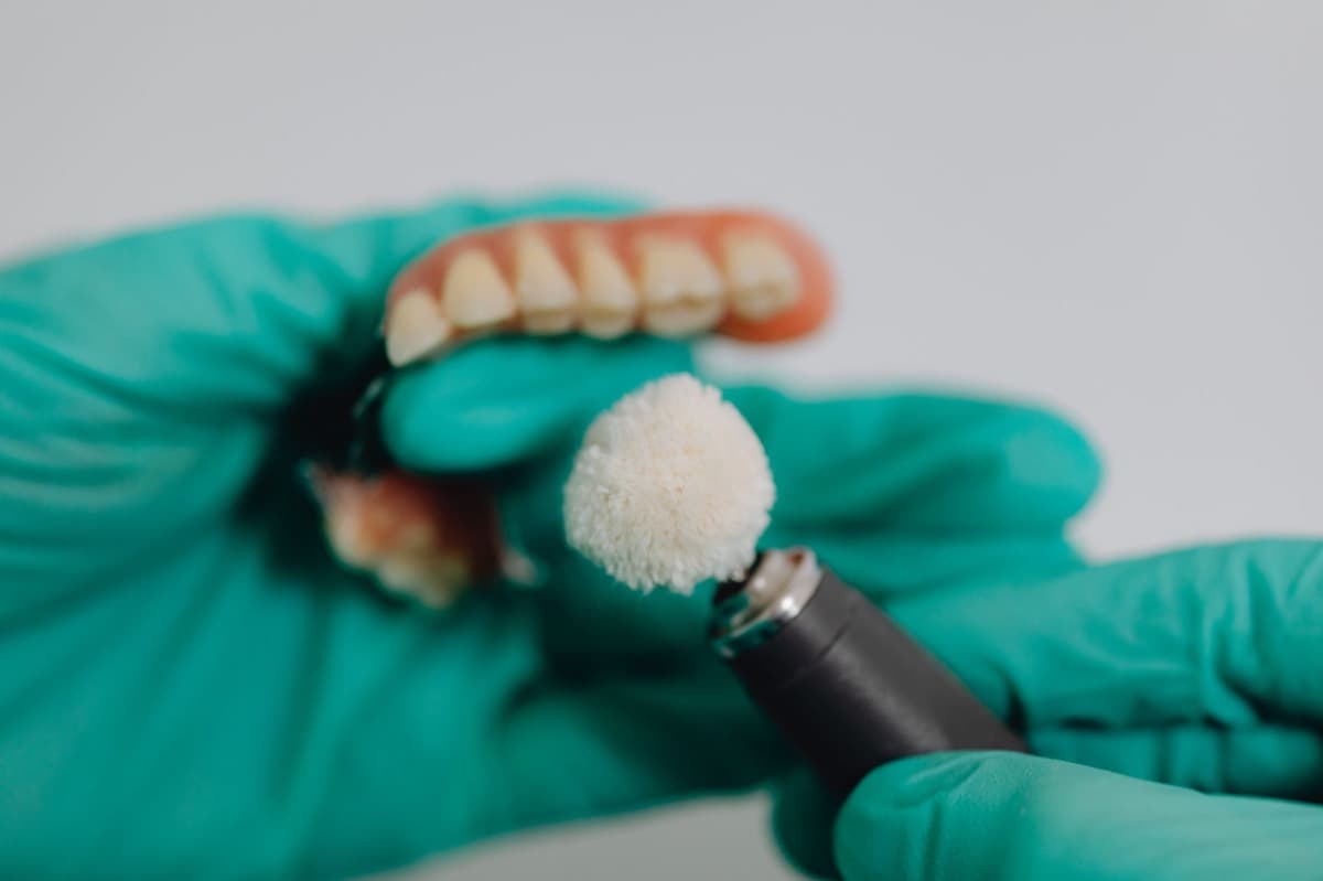 Proteze dentare Bacău — lucrare finisată la Chromatic Dental Clinic