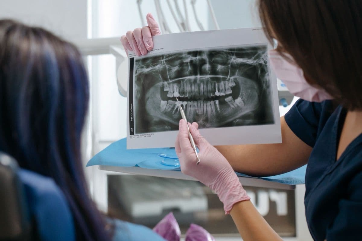 Medic stomatolog explicând radiografia unui implant eșuat la evaluarea din Bacău