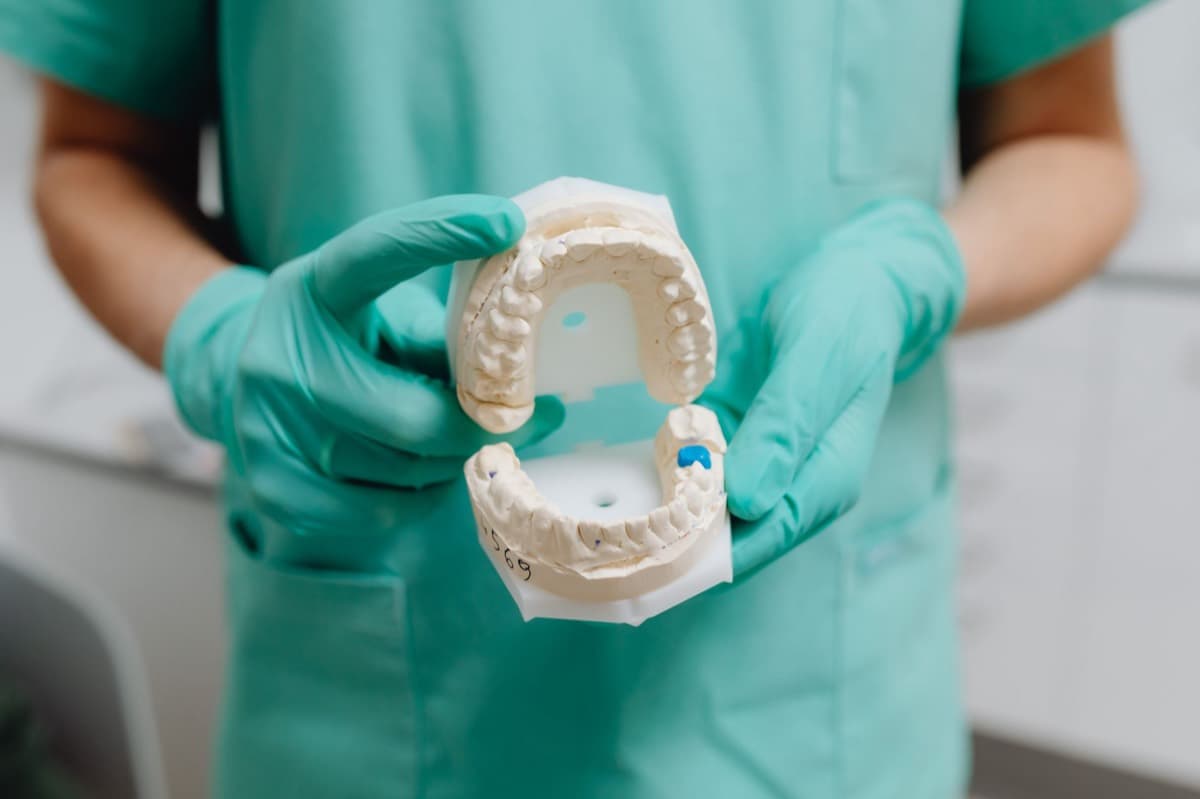 Coroane dentare Bacău — model de lucrare protetică la Chromatic Dental Clinic