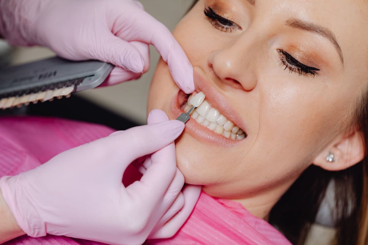 Fațete dentare Bacău — proba nuanței pe dinții frontali la Chromatic Dental Clinic