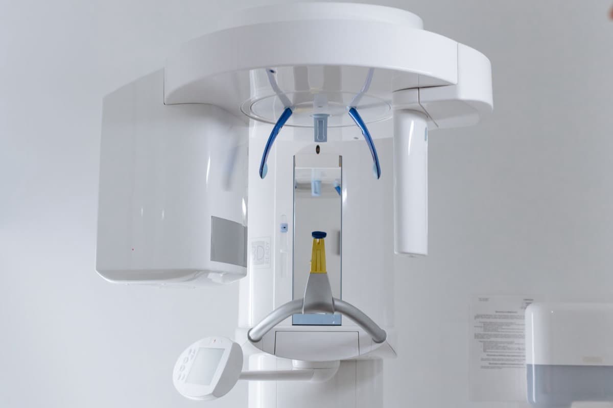 Radiologie dentară Bacău — aparat de radiografie la Chromatic Dental Clinic