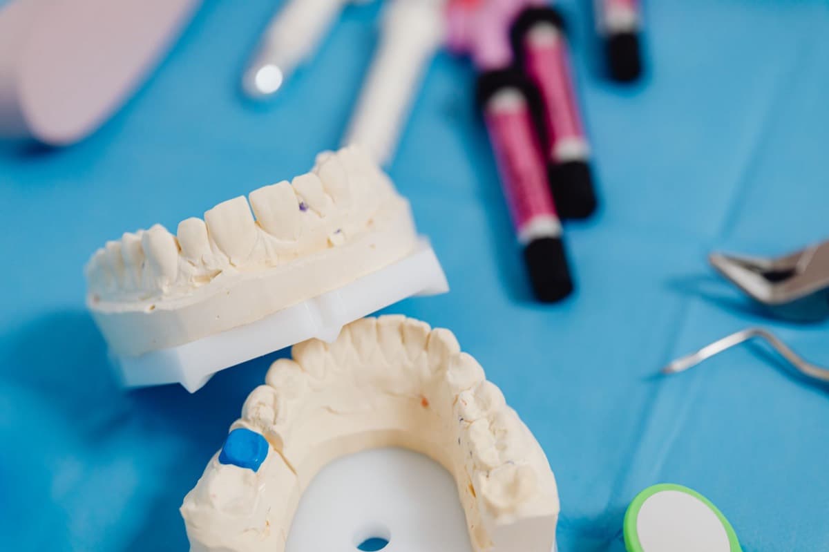 Model de arcadă cu tipuri de coroane dentare folosite la clinica din Bacău