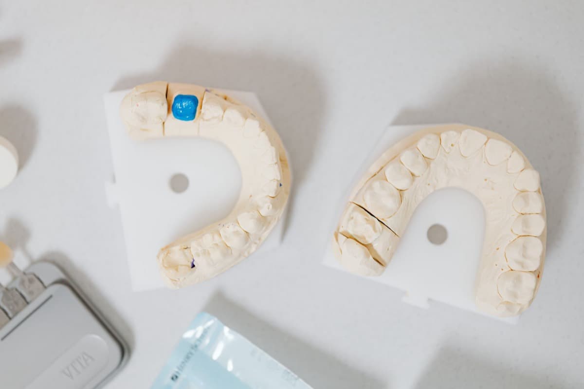 Modele de studiu și cheia de culori folosite pentru fațete dentare ceramice în Bacău